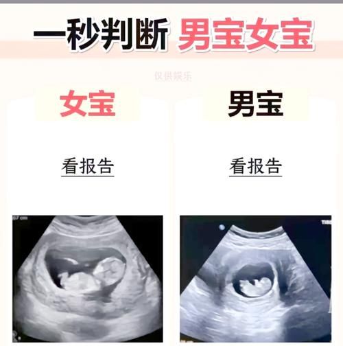 【SLG】【胎儿性别转变 Ver1.6全CG】【1.5G】【百度云下载】