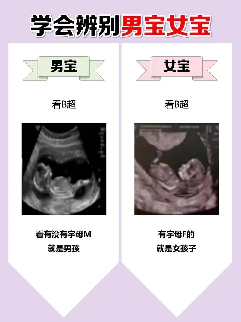 【SLG】【胎儿性别转变 Ver1.6全CG】【1.5G】【百度云下载】