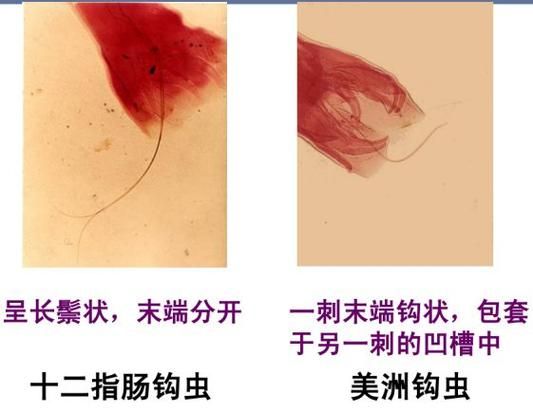 内部寄生虫在哪下载免费？热门资源平台推荐下载方式！