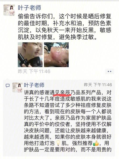 失忆官网用户反馈如何？(真实评价告诉你)