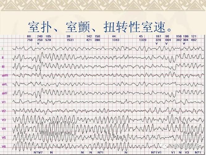 心脏问题在哪下载靠谱？实测5款软件告诉你答案