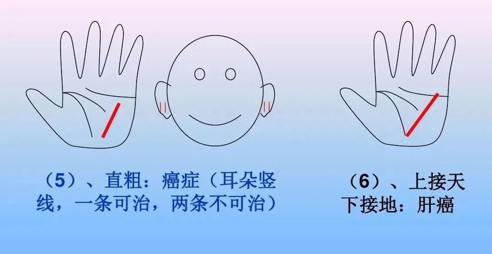 心脏问题游戏下载步骤全解？新手跟着操作一看就懂！